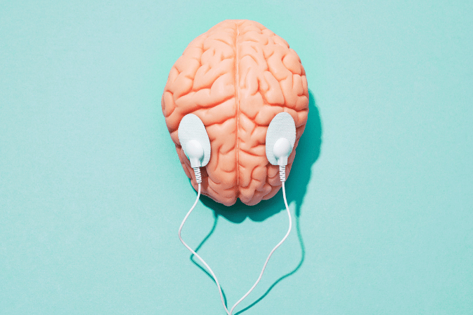 Estimulacion cerebral profunda